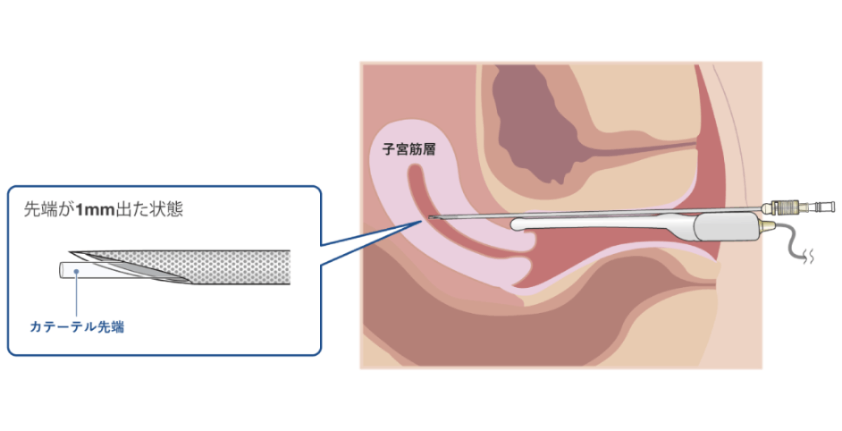 TOWAKO®メソッド プロトコール
